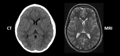 Whats The Difference Between An Mri And Ct Cincinnati Childrens Blog