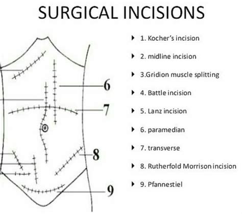 Types Of Incisions Medizzy