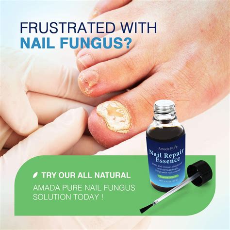 Toenail Fungus Treatment Nail Fungus Treatment Fungus Stop
