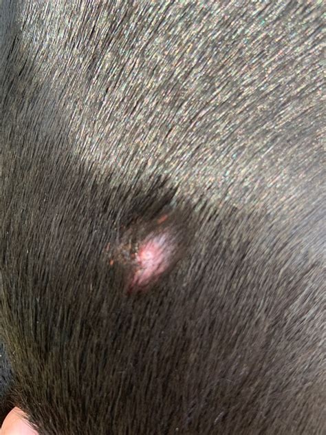 Hard Pink Lump On Dogs Outer Abdomen Its On The Surface And Moves