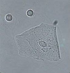 A small amount of epithelial cells in your urine is normal. Microscopic Examination of Urine Flashcards - Cram.com