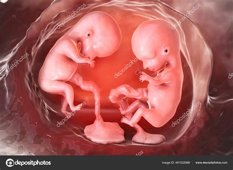 Monozygotic Twins Uterus Separate Placentas Illustration Early Fetal