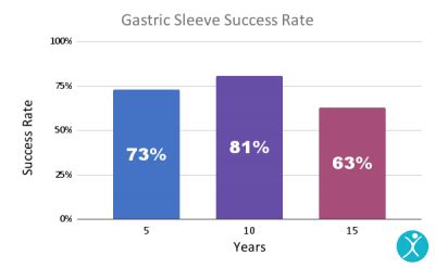Gastric Sleeve Success Rates Years After Mexico Bariatric Center