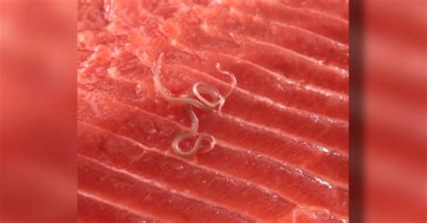 Worms Found In Salmon Bought From Costco