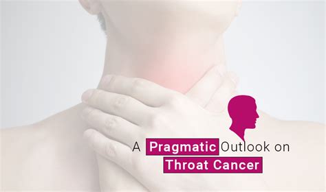 A Pragmatic Outlook On Throat Cancer Cancer Healer Center