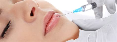 Lip Fillers Sydney Lip Enhancement Injections Skinnovation