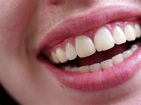 The Importance Of Gum Health Stensland Dental Studio