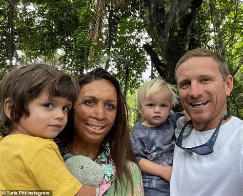 The Six Words Turia Pitt S Husband Told Doctors As She Lay Dying And Severely Burnt Daily Mail