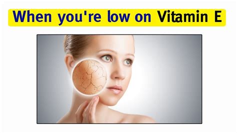 Vitamin E Top 10 Signs And Symptoms Of Vitamin E Deficiency Youtube