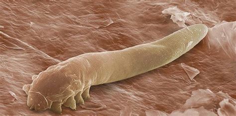 Humidity is the most important factor. Stop Hair Loss Due to Hair Mites - VisiHow