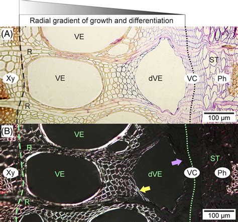 Transverse Sections Of Vascular Cambium And Adjacent Tissues Of A