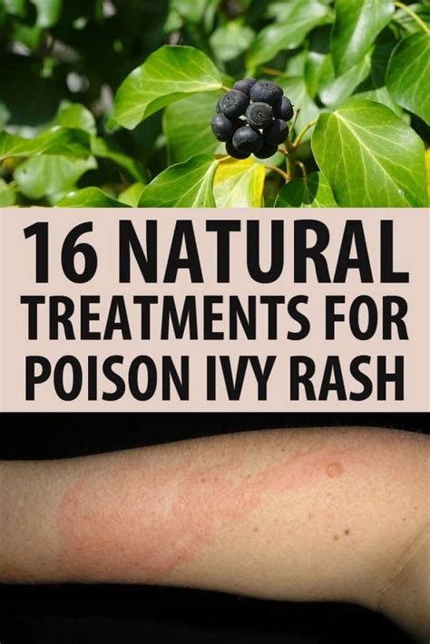 16 Natural Treatments For Poison Ivy Rash • New Life On A Homestead