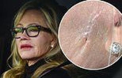 Melanie Griffith 65 Is Seen With Scar On The Left Side Of Her Face While Out Trends Now