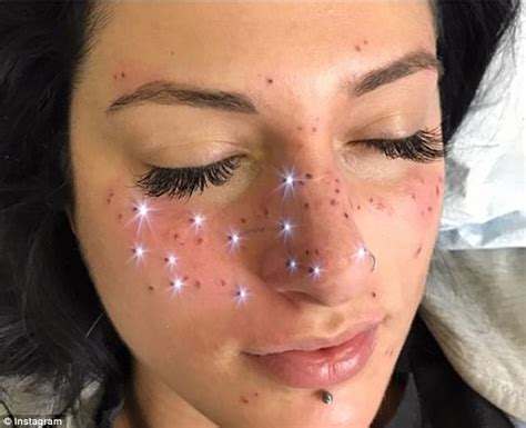 People Are Getting Star Signs Tattooed As Freckles Daily Mail Online