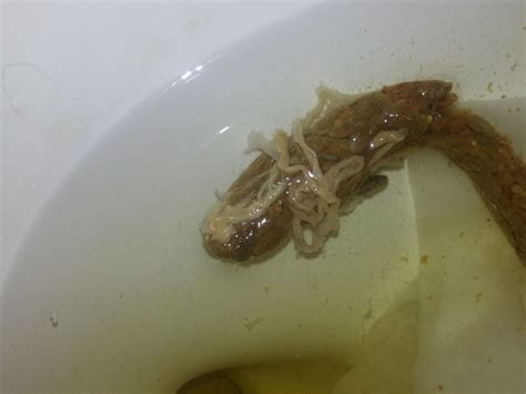 What Do Pinworms Look Like In Your Stool Sipcbp