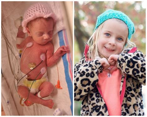 Photos Of Premature Babies Then And Now Show Their Incredible Journey