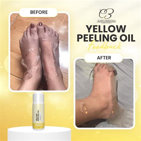 Yellow Peeling Oil Clarity Essentials 120ml 60ml 15ml Shopee