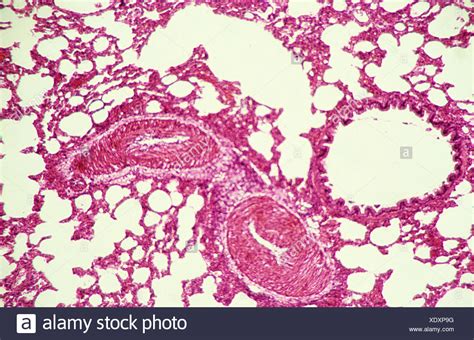 Pulmón Bronquiolo Alvéolos Músculo Liso Arteria 100 X Microscopio