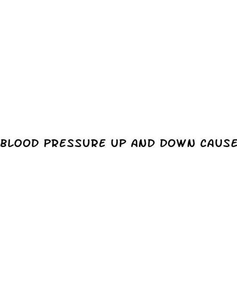 Blood Pressure Up And Down Causes Diocese Of Brooklyn