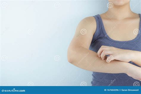 Close Up Woman Scratching Her Itchy Arm With Allergy Rash By Hand On