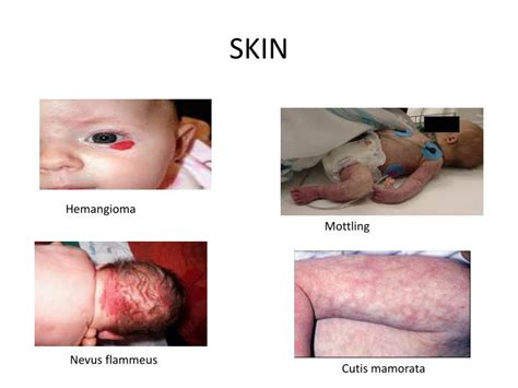 Ppt Physical Examination Of The Newborn Powerpoint Presentation Id