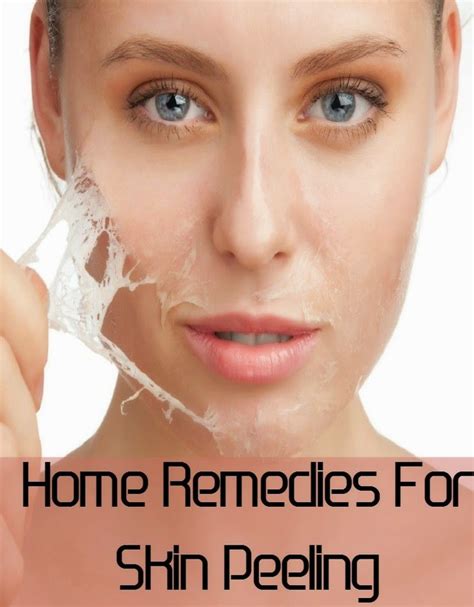 Home Remedies For Lost Voice Dry Skin On Face Peeling Skin Chemical