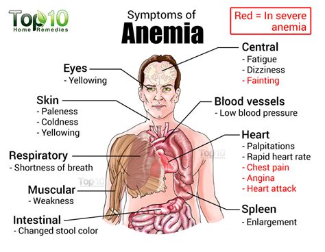 Part 2 Iron Deficiency Anemia | Strive For Good Health