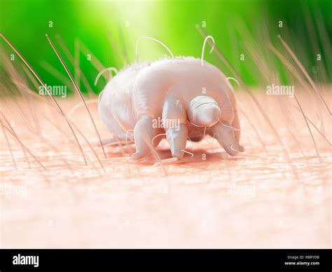 Illustration Of A Scabies Mite On Human Skin Stock Photo Alamy