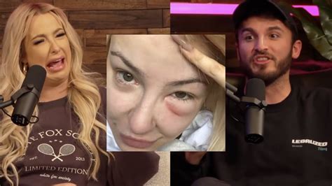 Tana Mongeau Has Serious Teeth Problems Unfiltered Podcast Highlights