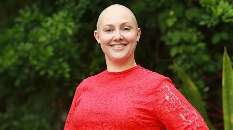 Alopecia Sufferer Bianca Young Embraces Baldness With A Close Shave Au — Australias