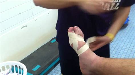 Turf toe refers to an injury that affects the ligaments around a person's big toe. Turf Toe Taping Into Extension - YouTube
