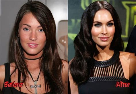 Megan Fox Before And After Plastic Surgery A Tale Of Evolution Asean Tv