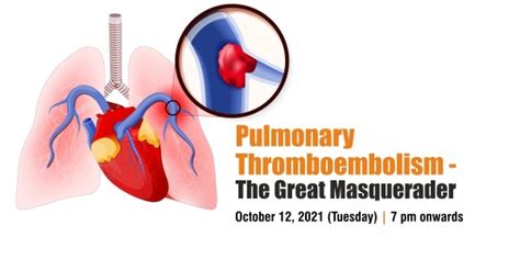Pulmonary Thromboembolism The Great Masquerader