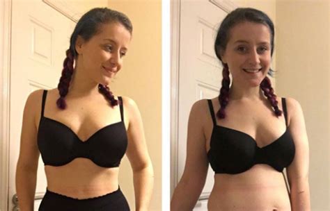 This Woman Sent A Very Powerful Statement With These Before And After