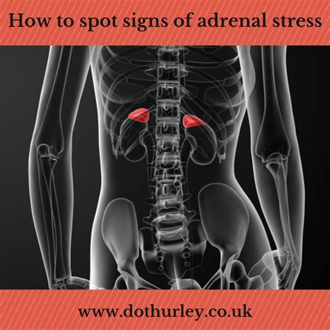 How To Spot Signs Of Adrenal Stress Dot Hurley Natural Health
