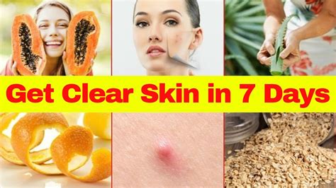 10 Home Remedies To Get Clear Skin How To Get Clear Skin Naturally