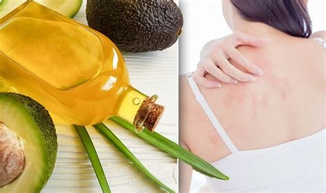Eczema Treatment Prevent Dry And Itchy Skin At Home With An Avocado