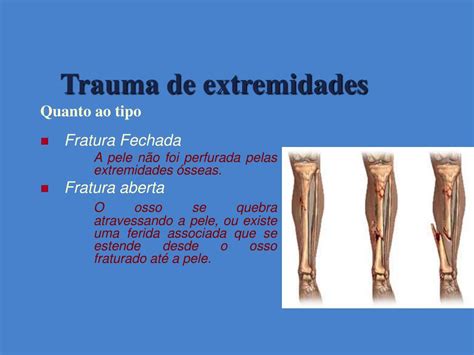 Cid Trauma Membro Inferior