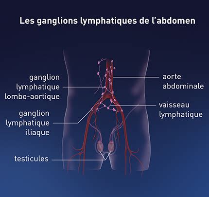 Traitement Du Cancer Des Ganglions Lymphatiques Dusilabuluu