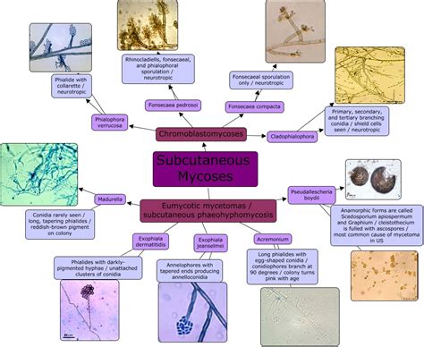 Monophora, is described using multilocus molecular data including aflp profiles, sequences of the. Subcutaneous Mycoses