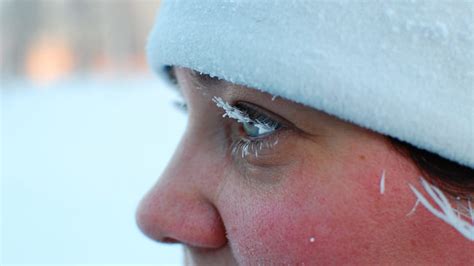 Its So Cold In One Part Of Russia That Peoples Eyelashes Are Freezing