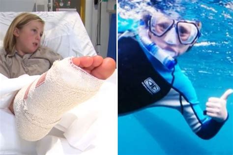 Boy 10 Mauled By Shark Reveals Horrifying Moment He Thought ‘im