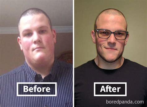 128 Surprising Photos Of Face Fat Loss Before And After Weight Loss