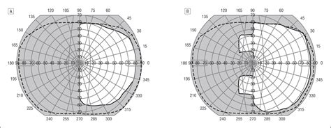 Community Based Trial Of A Peripheral Prism Visual Field Expansion
