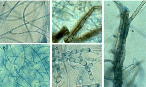 Microscopic Characteristic Of Hyphae With Different Treatments
