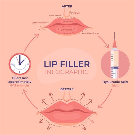 Lip Filler Swelling Stages Heres What To Expect Celebritystyleguide