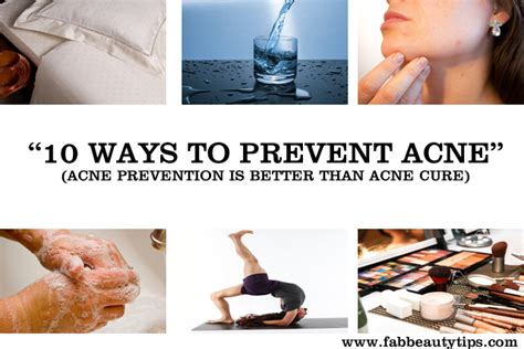How To Prevent Acne And Pimples Top 10 Tips To Eliminate Acne