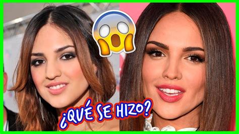 Injerto capilar antes y después. ANTES Y DESPUES EIZA GONZALEZ 💰 cirugías - EXPLICADO ️ ...