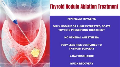 Treating Thyroid Nodule Without Surgery In Hyderabad Non Surgical
