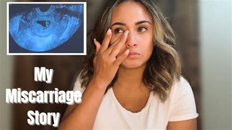 My Miscarriage Story 10 Weeks Live Ultrasound Youtube